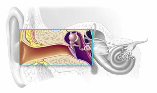 Inner Ear Conductive